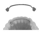 Lingual Retainer Upper 2-2 Pack of 2